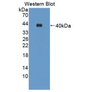 Western blot analysis of the recombinant protein.