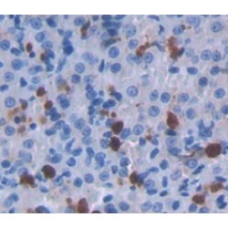 Aminolevulinate Delta Dehydratase (ALAD) Antibody