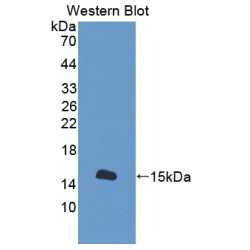 S100 Calcium Binding Protein A16 (S100A16) Antibody