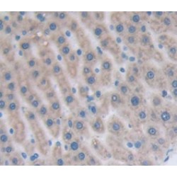 Macrophage Derived Chemokine (MDC) Antibody