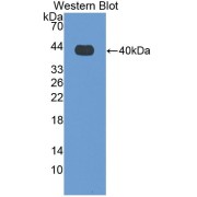 Western blot analysis of the recombinant protein.