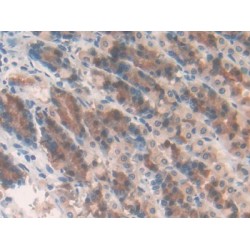 Matrix Metalloproteinase 10 (MMP10) Antibody