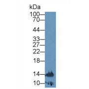 Western blot analysis of Rat Lymphocyte lysate, using Rat TNFb Antibody (2 µg/ml) and HRP-conjugated Goat Anti-Rabbit antibody (<a href="https://www.abbexa.com/index.php?route=product/search&amp;search=abx400043" target="_blank">abx400043</a>, 0.2 µg/ml).