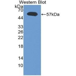 Lymphotoxin Alpha (LTA) Antibody