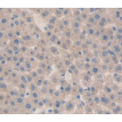 Lymphotoxin Alpha (LTA) Antibody