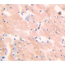 Myoglobin (MB) Antibody