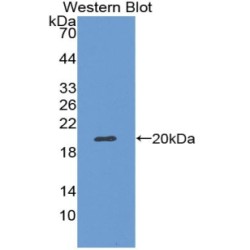 Nitric Oxide Synthase, Inducible (NOS2) Antibody