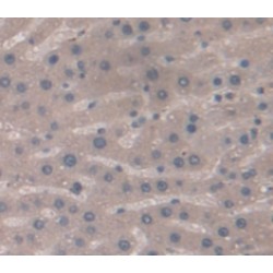 Nitric Oxide Synthase, Inducible (NOS2) Antibody