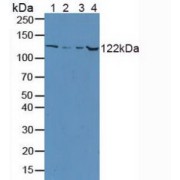 Western blot analysis of (1) Rat Lung Tissue, (2) Rat Brain Tissue, (3) Rat Liver Tissue and (4) Rat Serum.