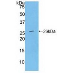 Ceruloplasmin (CP) Antibody