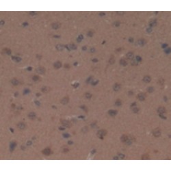 Ceruloplasmin (CP) Antibody