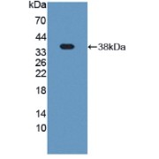 Western blot analysis of recombinant Rat Plg.