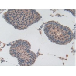 Plasminogen (Plg) Antibody