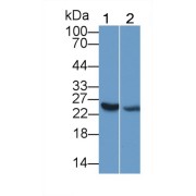 Western blot analysis of Rat (1) kidney and (2) spleen lysate using IL25 antibody (0.5 µg/ml) and HRP-conjugated Goat anti-Rabbit antibody (<a href="https://www.abbexa.com/index.php?route=product/search&amp;search=abx400043" target="_blank">abx400043</a>, 0.2 µg/ml).