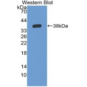 Western blot analysis of the recombinant protein.