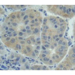 Interleukin 6 Receptor (IL6R) Antibody