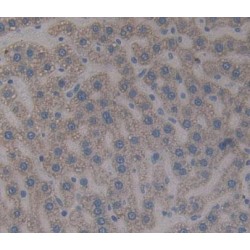 Hemopexin (HPX) Antibody