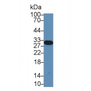 Western blot analysis of Rat Serum, using Rat C1qA Antibody (3 µg/ml) and HRP-conjugated Goat Anti-Rabbit antibody (<a href="https://www.abbexa.com/index.php?route=product/search&amp;search=abx400043" target="_blank">abx400043</a>, 0.2 µg/ml).