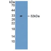 Western blot analysis of recombinant Rat IL17RD.