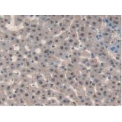 Interleukin 17 Receptor D (IL17RD) Antibody