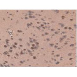 Interleukin 17 Receptor D (IL17RD) Antibody