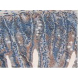 Interleukin 17 Receptor D (IL17RD) Antibody