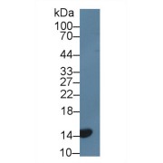 Western blot analysis of Rat Serum, using Rat CDKN2A Antibody (5 µg/ml) and HRP-conjugated Goat Anti-Rabbit antibody (<a href="https://www.abbexa.com/index.php?route=product/search&amp;search=abx400043" target="_blank">abx400043</a>, 0.2 µg/ml).