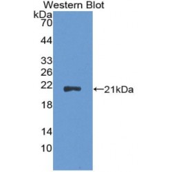 Cyclin-Dependent Kinase Inhibitor 2A (CDKN2A) Antibody