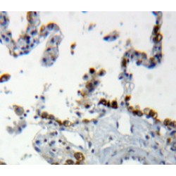 Cyclin-Dependent Kinase Inhibitor 2A (CDKN2A) Antibody