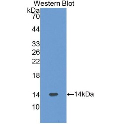 Pre-B-Lymphocyte Gene 1 (VPREB1) Antibody