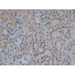 Pre-B-Lymphocyte Gene 1 (VPREB1) Antibody