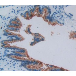 Pre-B-Lymphocyte Gene 1 (VPREB1) Antibody