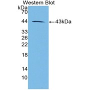 Western blot analysis of recombinant Rat GAL.