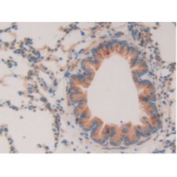 Ring Finger Protein 112 (RNF112) Antibody