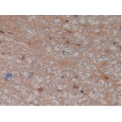 Ring Finger Protein 112 (RNF112) Antibody