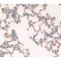 CD97 Antigen (ADGRE5) Antibody