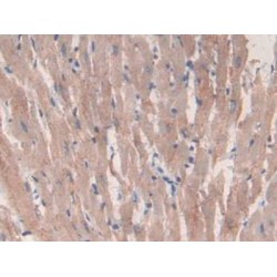 Citrate Synthase (CS) Antibody