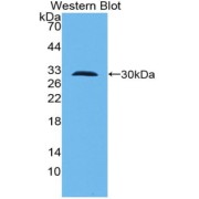 Western blot analysis of the recombinant protein.