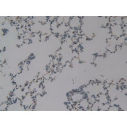 Bone Morphogenetic Protein 3 (BMP3) Antibody