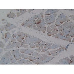 Bone Morphogenetic Protein 3 (BMP3) Antibody