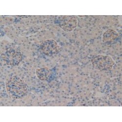 Podocalyxin (PODXL) Antibody