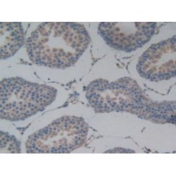 Podocalyxin (PODXL) Antibody