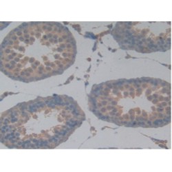 Microtubule-Associated Protein Tau (MAPT) Antibody