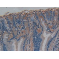Microtubule-Associated Protein Tau (MAPT) Antibody