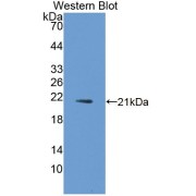 Western blot analysis of the recombinant protein.