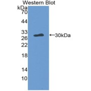 Western blot analysis of the recombinant protein.