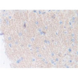 Thrombopoietin (THPO) Antibody