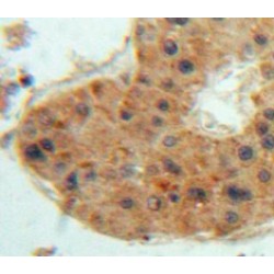 Thrombopoietin (THPO) Antibody