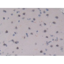 Interleukin 17 Receptor A (IL17RA) Antibody