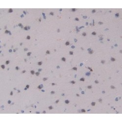 Interleukin 17 Receptor A (IL17RA) Antibody